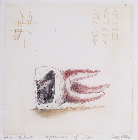 Specimens Of Loss (Teeth)